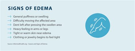 Edema In One Leg What Causes Swelling In One Leg Only Tactile Medical