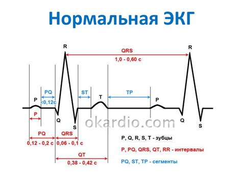 Практикум по ЭКГ - online presentation