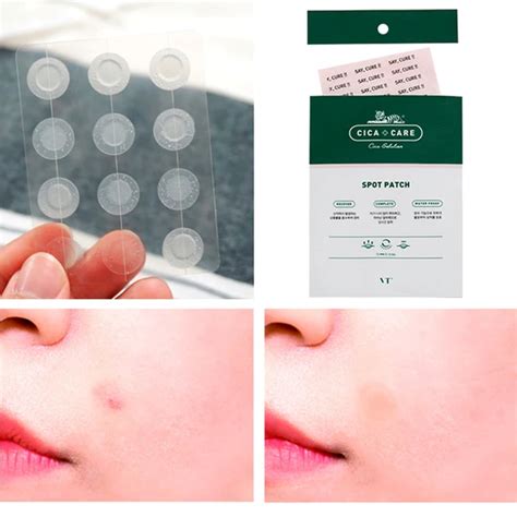 12 Patches Face Spot Scar Care Acne Pimple Master Patch Treatment ...