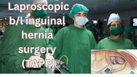 Laproscopic B L Inguinal Hernia Repair Tapp Approach With Anatomical