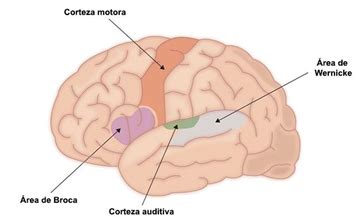 Estudios De Broca Y Wernicke Tulia Ocampo Gaviria