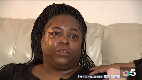 Woman Speaks Out After Surviving Shooting Carjacking In West Garfield