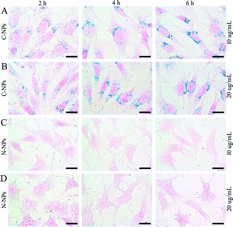 A Novel Polymeric Micelle Used For In Vivo Mr Imaging Tracking Of