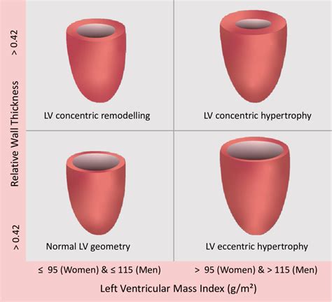 Sex Specific Lv Geometry Patterns According To Current Guidelines 10 Download Scientific