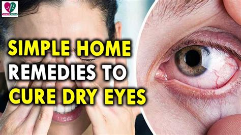 Home Remedies To Cure Dry Eyes Remedies For Healthy Eyes Tips For Eye Care Dry Eyes