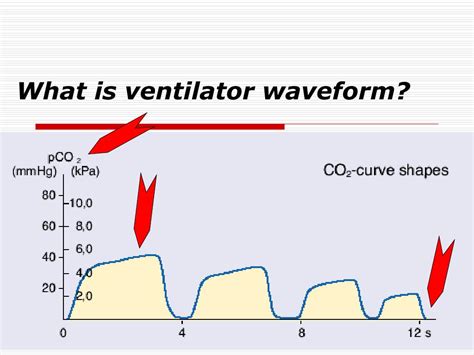 PPT - Interpretation of Ventilator Graphics PowerPoint Presentation - ID:232693