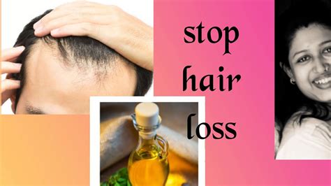 Hair Fall Control Tips In Men How To Stop Hair Fall Youtube