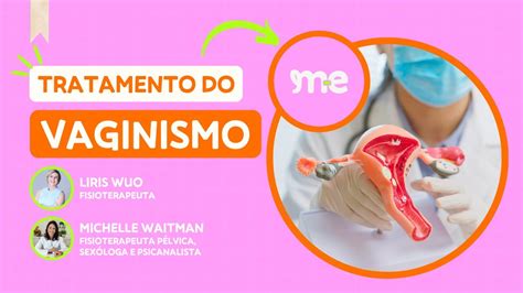 Tratamento Do Vaginismo Por Aline Pedrazzi YouTube