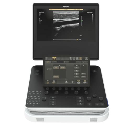 Used Philips Portable Compact 5300 Point Of Care Ultrasound Machine For Sale From Strata Imaging