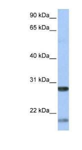 Anti BDNF Rabbit Polyclonal Antibody VWR