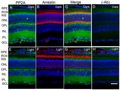 Immunofluorescence Analysis Of Pp2a In Mouse Retina Prefer Fixed Download Scientific Diagram