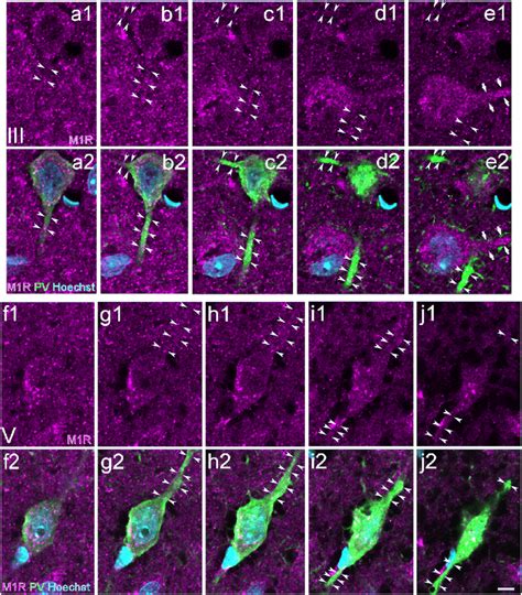 Fig Ure 8 Intradendritic Signals Of M1r Immunopositivity In Pv Neurons