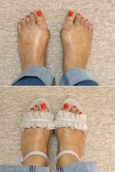 Pin On Beautiful Shoes For Bunions