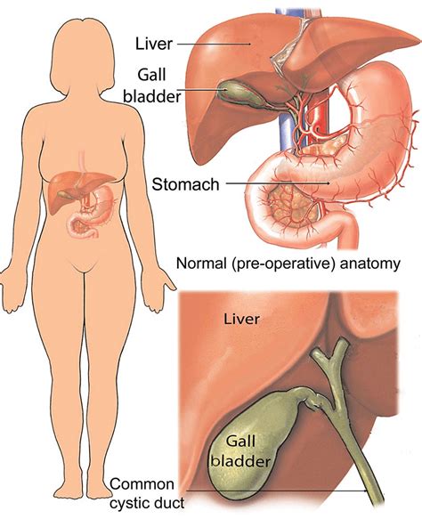 Gallbladder Pain Location Diagram - exatin.info