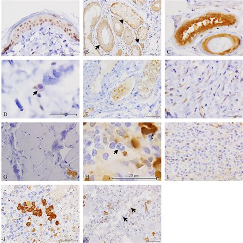 The Staining Properties Of Peroxiredoxin Prdx And In The Newly