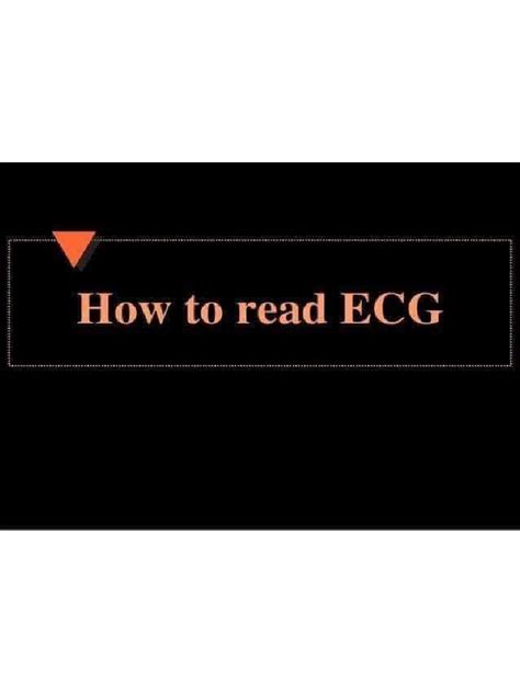 How To Read Ecg Pdf