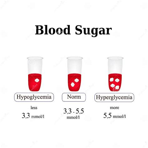 El Nivel De Azúcar En La Sangre Hypoglycemia Hyperglycemia Infografía