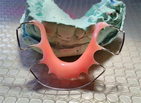 Instructions For How To Use Removable Orthodontic Appliances