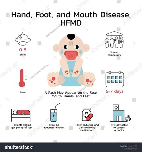 Hand Foot Mouth Disease Hfmd Symptoms Stock Vector Royalty Free