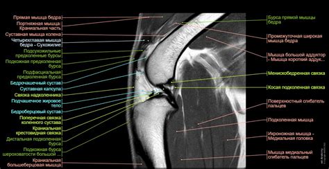 Собака ‒ Коленный сустав MPT - нормальная анатомия | vet-Anatomy