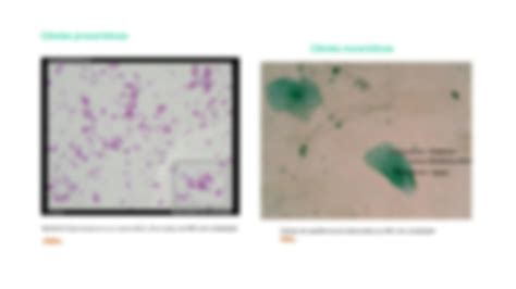 Solution Ppt N B Observa O Microscopica De Celulas Studypool