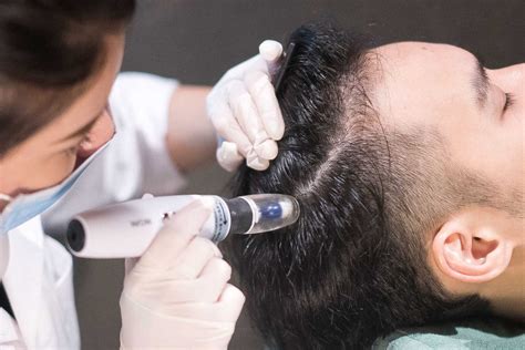 What Are The Benefits Of Mesotherapy For Hair Mth