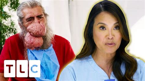 Dr Pimple Popper New Episodes Archives Pimple Popping Videos