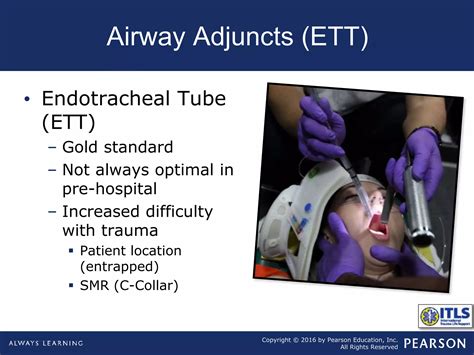 Chapter4 airway management | PPT