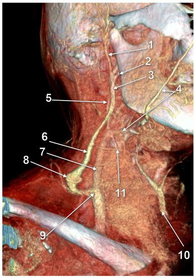 Anatomical Variations Of The External Jugular Vein A Pictorial And Critical Review