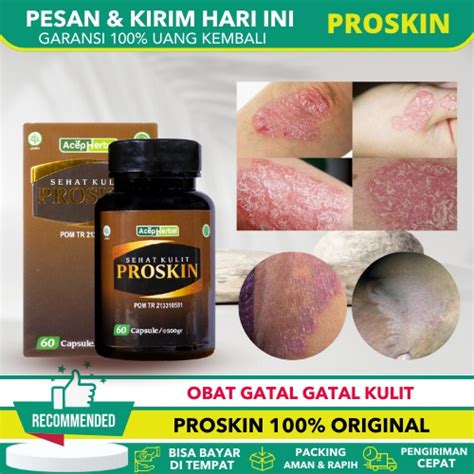 Jual Obat Gatal Kulit Obat Gatal Jamur Kulit Obat Gatal Selangkangan