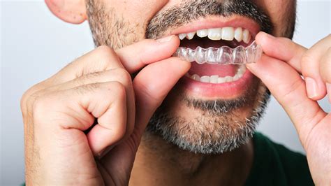 Invisalign Vs Braces Which Is Better For You Goodrx