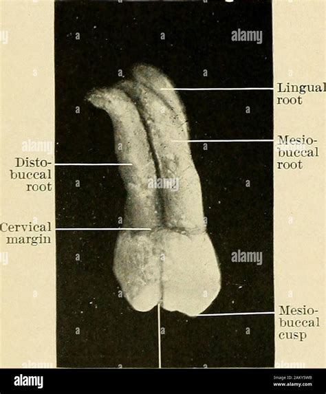 Principles And Practice Of Operative Dentistry Marginalridge Fig 62