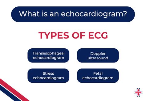 Exploring the Contrasts Between An ECG And An EKG Test | ER of Mesquite