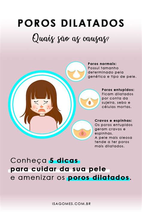 Dicas Para Amenizar Poros Dilatados Poros Entupidos Cravos E