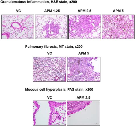 Representative Mt And Pas Stained Slides Of Lungs Obtained From Mice