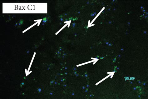 Immunofluorescence Caspase 9 P53 And Bax A Control Cells Showing