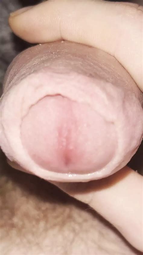 Juego De Prepucio De Cerca Con Precum Xhamster