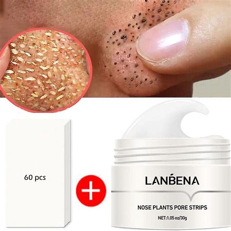 Lanbena Blackhead Remover Cream Pore Strips Nose Acne Deep Clean Peel