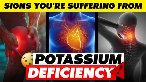 7 Alarming Signs You Re Suffering From Potassium Deficiency Youtube