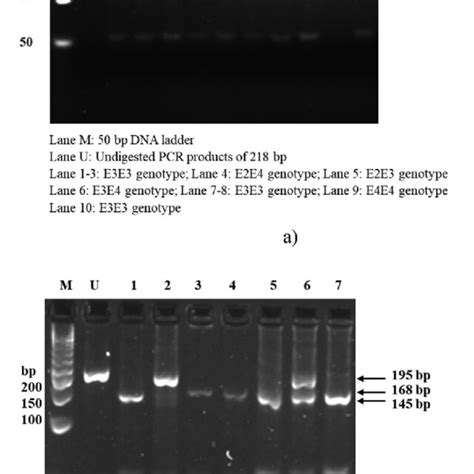 Apoe Genotyping By Pcr Rflp A B 4 Agarose Gel Electrophoresis Of