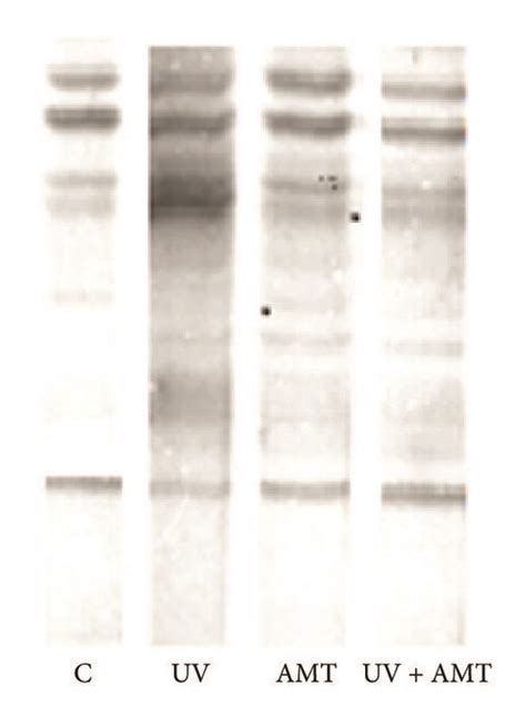 The Effect Of Uva Exposure Amt Treatment And Concurrent Amt Treatment