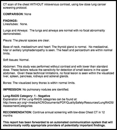 Lung Cancer Screening Ct Report Template