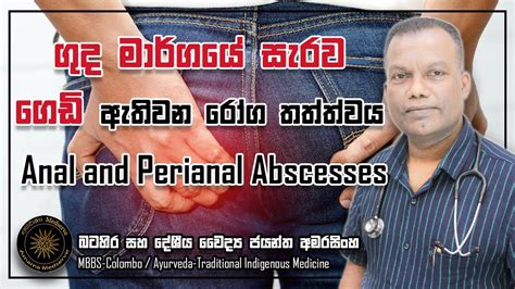 ගද මරගය සරව ගඩ ඇතවන රග තතතවය Anal and Perianal Abscesses YouTube