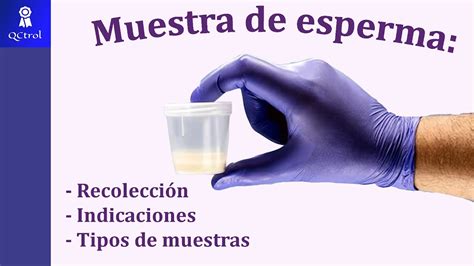 Cu Les Son Las Indicaciones Para Muestras De Semen Espermatobioscop A