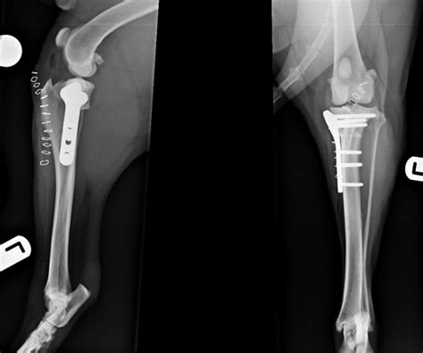 Frontiers Biomechanical Comparison Of Tibial Plateau 41 OFF