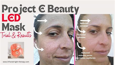 Project E Beauty LED Face Mask Before and After (30 Days)