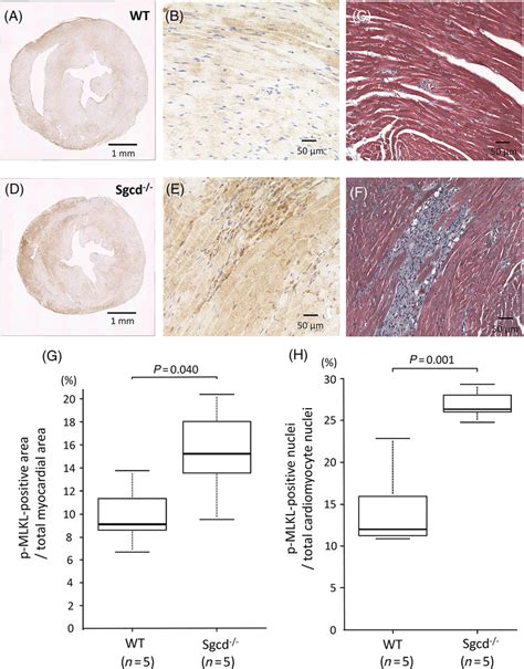 Pmlkl Level In A Mouse Model Of Dilated Cardiomyopathy A B D E