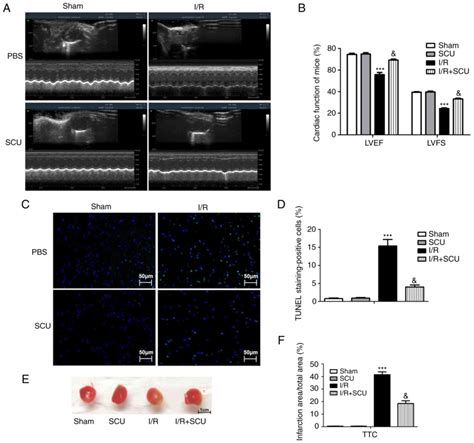 Scutellarin Ameliorates Ischemia Reperfusion Injuryinduced