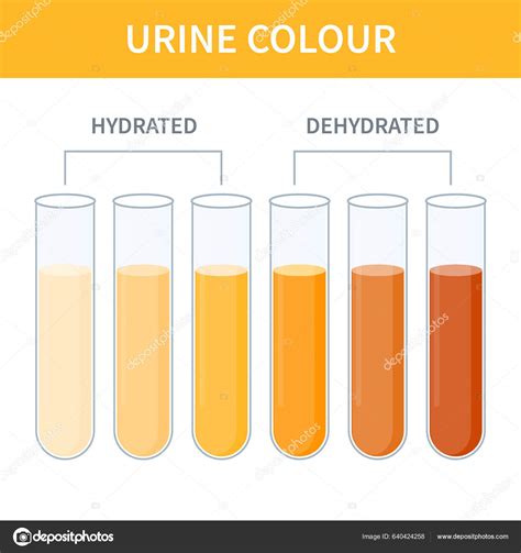 Urine Colour Chart Hydration Dehydration Level Diagram Medical Urinal Test Vector De Stock