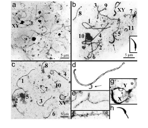 Electron Micrographs Of Nuclei From Spermatocytes I And Spermatozoa Of